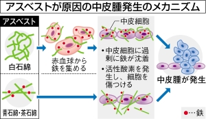 石綿中皮腫は「鉄」原因 名大院教授ら発見