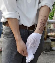 男子中学生がいじめで肋骨折る 児相に通告、東京・清瀬