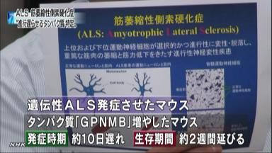 難病:ＡＬＳ進行抑制の遺伝子特定 岐阜薬科大など