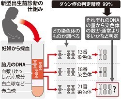 新型出生前診断:今月にも開始 高い精度 心のケアに遅れ