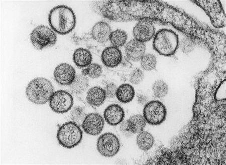 ヨセミテ滞在で死者３人目 ハンタウイルス感染