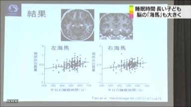 よく寝る子ほど脳の「海馬」大きく