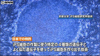 京大ｉＰＳ細胞 日米で新特許成立