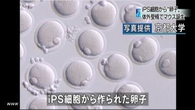 ｉＰＳ細胞から卵子作製 マウスで成功…京大