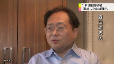 ｉＰＳ臨床問題:山中氏論文盗用の疑い…ネイチャー電子版