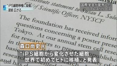 47NEWS ＞ 共同ニュース ＞ 厚労省、森口氏関与の研究を調査 補助金で３件