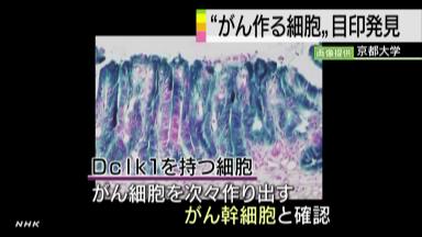 がん幹細胞を見つけ出す方法開発