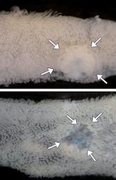 大腸がん幹細胞の目印を発見 京大グループ