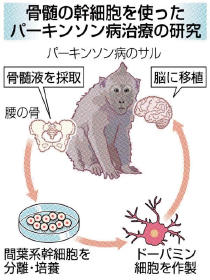 東北大など、幹細胞由来の神経を脳に移植－パーキンソン病改善をサルで確認