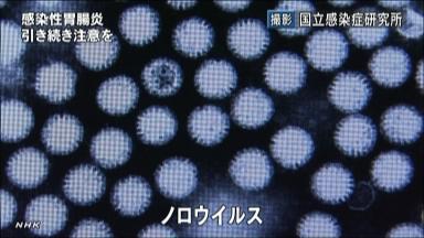ノロウイルス:集団感染した宮崎の病院、院長も発症