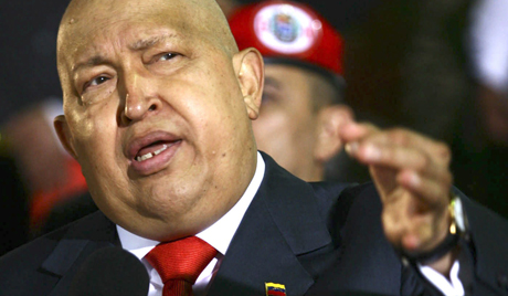 チャベス大統領、新たな合併症