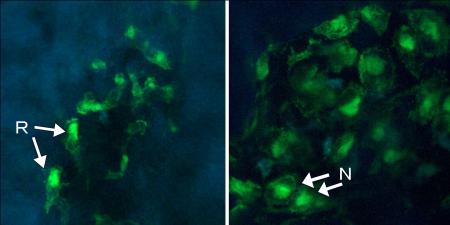 阪大、細胞が骨を壊す様子を観察 骨粗しょう症薬に期待