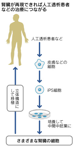 ヒトｉＰＳから腎臓細胞 京大、新治療法に道