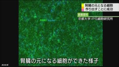 世界初！京大がヒトiPS細胞から腎細胞生成に成功