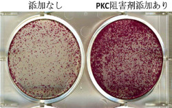 NIBIO、ヒトES/iPS細胞の培養を難しくしている原因のタンパク質を同定