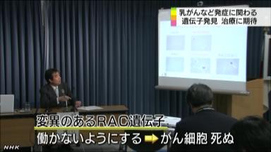 強力がん遺伝子:自治医大チーム発見 新たな治療薬に期待