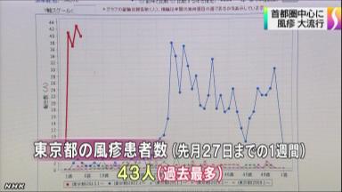 風疹:感染拡大、ワクチン接種を 県が対策協議 ／福井