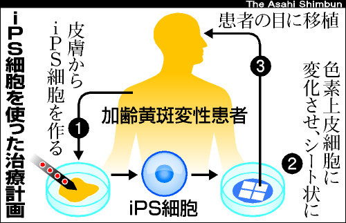 アピタルトップ ＞ ニュース ＞ ｉＰＳ臨床応用、理研が正式決定 厚労省へ計画書提出