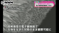 生きた虫、電子顕微鏡で観察＝保護膜開発—工業、医療応用に期待・浜松医大