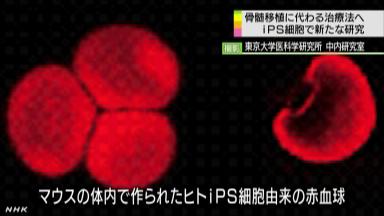 「血液のもと」の細胞、ｉＰＳ細胞から作製