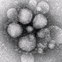 新種ウイルスは中東呼吸器症候群 ＷＨＯが命名