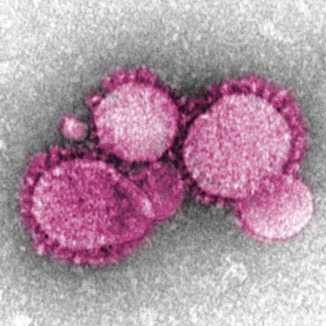 新種ウイルス、排せつ物で感染か 中東呼吸器症候群