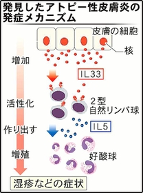 アトピー性皮膚炎のメカニズム明らかに 新薬開発に期待