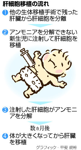 アピタルトップ ＞ ニュース ＞ 生後１１日男児に肝細胞移植 成育医療センター、国内初