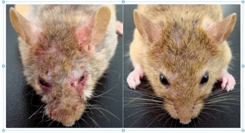 アトピー緩和の物質 京大チーム発見、治療薬開発に期待