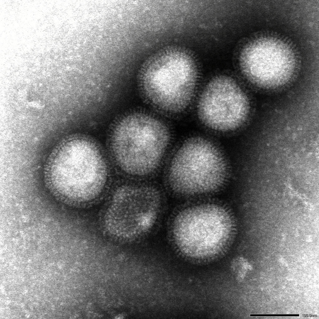 Ｈ７Ｎ９型、香港で初の感染者 鳥インフル、女性重体