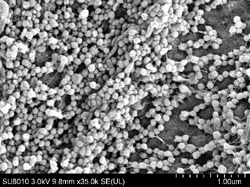 正しく知って、備えるには？ Ｈ７Ｎ９型鳥インフルエンザ