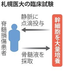 脊髄損傷、患者から採取の幹細胞で治療…国内初