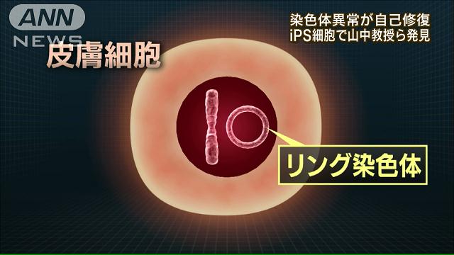 iPS細胞で染色体異常が自己修復 山中教授ら発見