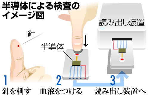 自宅でアルツハイマー病検査 愛知県や豊橋技科大などが機器