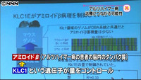 遺伝子発見 アルツハイマー治療の可能性も（大阪府）