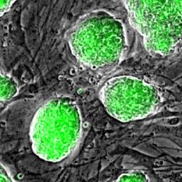 ｉＰＳの作製効率、２０倍に＝遺伝子働きやすい仕組み応用－マウスで成功・理研など