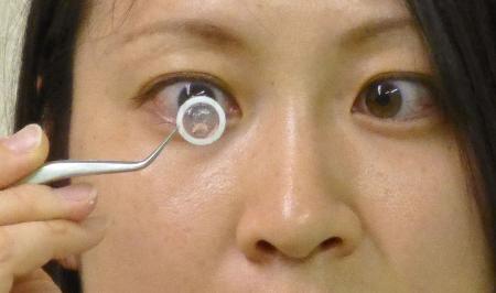 ブタのコラーゲンから角膜移植用の新素材 農業生物所など成功