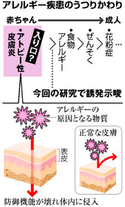 アレルギーの発症、保湿で減少か アトピー抑制が効果？