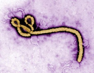 エボラ出血熱:対策できょう閣僚会議