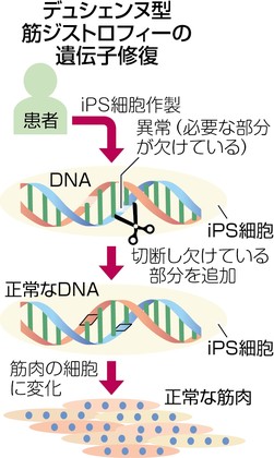 ｉＰＳで筋ジス遺伝子修復、京大 症状改善に光