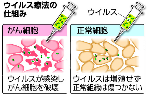 東大医科研 脳腫瘍のウイルス療法 医師主導治験開始