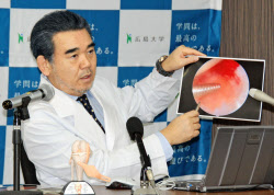 幹細胞、磁石で集め治療 広島大で欠損軟骨修復手術