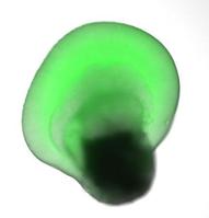 網膜再生:より現実的に ES細胞から作製、理研など成功