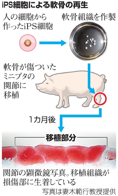 アピタルトップ ＞ ニュース ＞ 治りにくい軟骨、ｉＰＳで作製 京大「４年内に臨床へ」