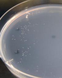 九州大、線虫を用いて尿1滴からがんを検出する技術を開発