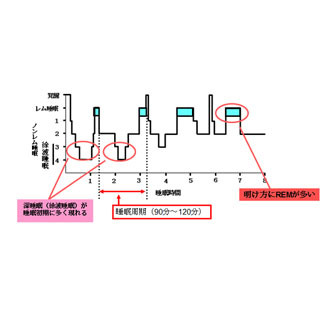 睡眠障害の改善が糖尿病の血糖改善などに有効であることを確認 - 大阪市立大