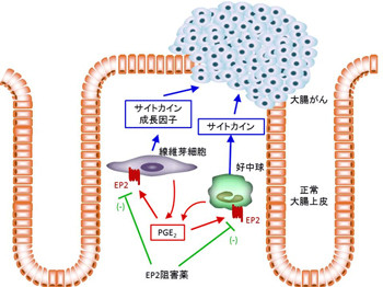 大腸がん防ぐ仕組み発見 京大、炎症起こす分子特定
