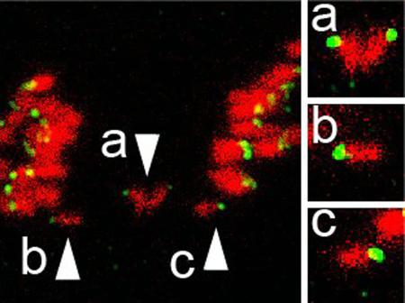 加齢による卵子異常、一部解明 理研など