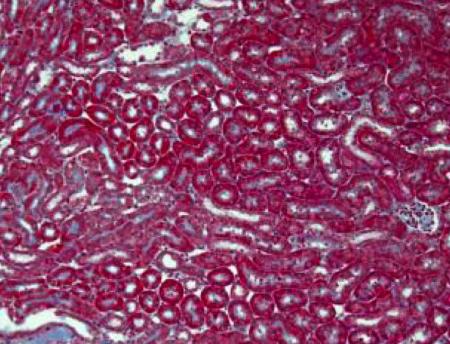 ｉＰＳ細胞：急性腎障害治療 京大研、マウス実験で