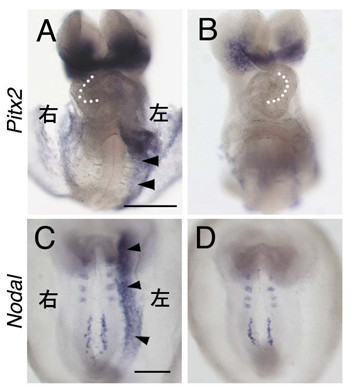 九州大、妊娠前糖尿病が胎児の先天性心疾患を引き起こす仕組みを解明